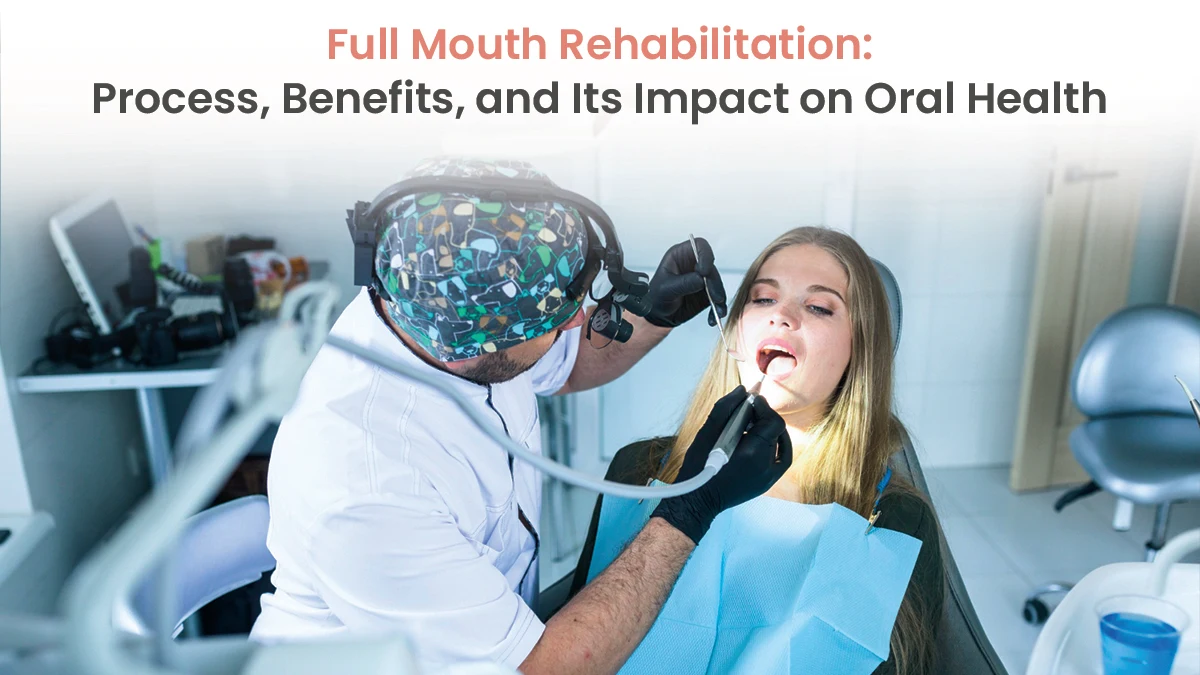 Full Mouth Rehabilitation: Process, Benefits, and Its Impact on Oral Health